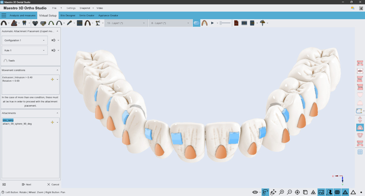 Deltaface, ArchForm, ONYXCEPH, 3Shape Ortho System, 3Shape Clear Aligner Studio, NemoCast, Nemotec, Ortho X Aligner, diorco, dentOne, 3dLeone, 3D Leone Designer, SureSmile Aligner, ulab, ulabsystems, blue sky bio, Maestro 3D, M3D, AGE Solutions, MDS500, Meilleur logiciel orthodontique, Logiciel de placement de brackets, Modèles d'étude numériques, Prototypage rapide pour la dentisterie, Scanner 3D pour la joaillerie, Scanner dentaire, Meilleur scanner dentaire, Logiciel orthodontique pour les aligneurs transparents, Conception numérique d'aligneurs transparents, Logiciel CAD/CAM orthodontique, Prototypage rapide pour l'orthodontie, Guide de production d'aligneurs, Solutions logicielles pour les aligneurs dentaires, Création numérique d'appareils orthodontiques, Modélisation 3D pour les aligneurs dentaires, Impression 3D directe d'aligneurs transparents, Logiciel de correction orthodontique, Technologie avancée pour les aligneurs, Logiciel de conception d'expandeurs, Découpe automatique des aligneurs, Logiciel Ortho Studio, Logiciel Dental Studio, Bandes numériques et expandeurs, Gouttière dentaire numérique, Protège-dents numérique, Segmentation automatique des dents basée sur l'intelligence artificielle, Orthodontie numérique basée sur l'intelligence artificielle, Logiciel de traitement orthodontique, Logiciel d'aligneurs dentaires basé sur l'intelligence artificielle, Aligneurs dentaires numériques basés sur l'IA, Solutions logicielles d'IA pour les aligneurs dentaires, Technologie d'IA pour la correction orthodontique, Planification orthodontique basée sur l'intelligence artificielle, Logiciel d'aligneurs dentaires basé sur le cloud, Solutions cloud pour l'orthodontie, Visionneuse web pour les cas orthodontiques, Lingual Holding Appliance (LLHA), Trans-Palatal Arch (TPA)