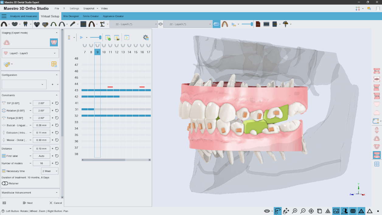 M3D, Dental Studio Expert, MDS500, 3D dental scanner, dental software, Maestro 3D, orthodontic software, dental impression scanner, dental prosthesis design, orthodontic treatment planning, digital dental appliances, digital dental workflow, dental CAD/CAM solutions