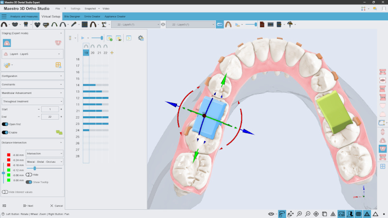 Advanced customization for each aligner